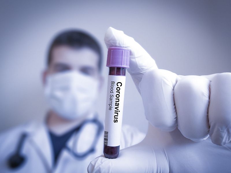 CoronaVirus Marathi News corona virus infection cases in the country slowed down sna | CoronaVirus News: दिलासादायक; देशात कोरोनाचा वेग मंदावला, गेल्या 24 तासांत 14 राज्यांमध्ये एकही रुग्ण नाही
