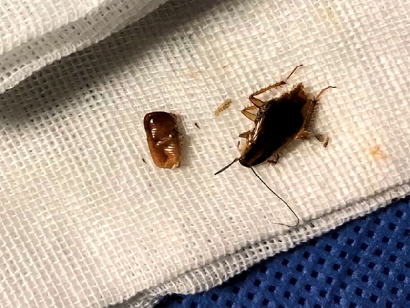 Man had family of cockroaches living inside ear canal and its horrifying | कानातचं थाटला होता झुरळानं संसार; डॉक्टरही झाले हैराण