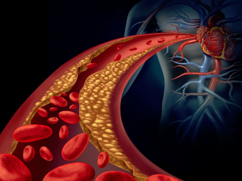 Ayurvedic methods to lower cholesterol level | हृदयरोगांपासून बचावासाठी कोलेस्ट्रॉल करा कमी, जाणून घ्या सोपे उपाय!