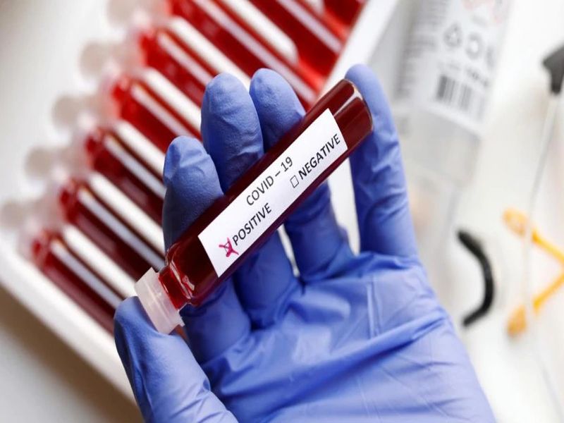 coronavirus: Corona test launched in Aurangabad | coronavirus: औरंगाबादेत कोरोनाची तपासणी सुरू