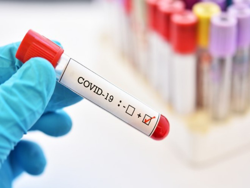 Corona Virus News : Corona tests in Pune city decreased; Two hundred new patients on Monday | Corona Virus News : पुणे शहरातील कोरोना चाचण्या घटल्या; सोमवारी दोनशे नवे रुग्ण 