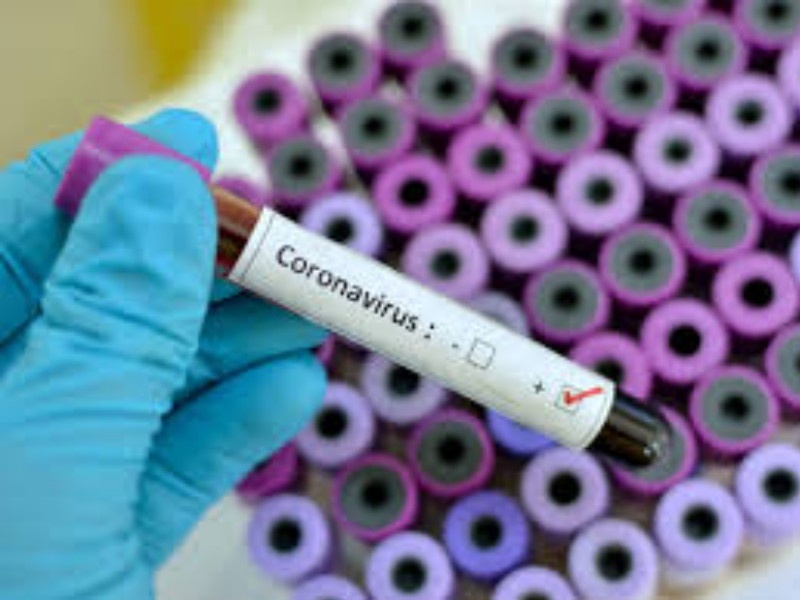 Corona virus : Corona's 'double century' in Pimpri in two and a half months, 22 people infected in one day | Corona virus : पिंपरीत अडीच महिन्यात कोरोनाचे ‘द्विशतक’, एका दिवसात २२ जणांना संसर्ग 