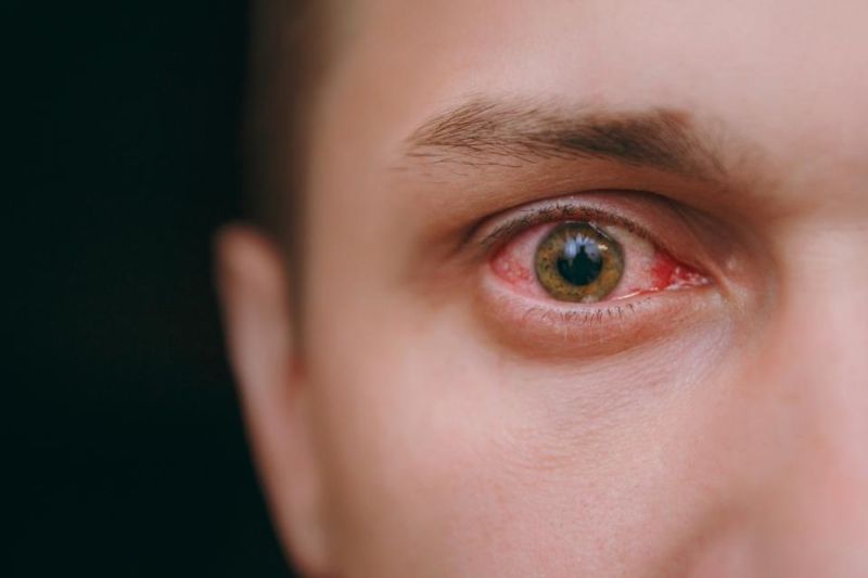Covid infection through eye: Take special care of the eyes | कोविडचा डोळ्यातूनही संसर्ग : डोळ्यांची विशेष काळजी घ्या