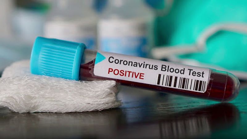 Number of coronaviruses stable in Vidarbha: 2,896 new patients, 19 deaths | विदर्भात कोरोनाबाधितांची संख्या स्थिर : २,८९६ नवे रुग्ण, १९ मृत्यू 