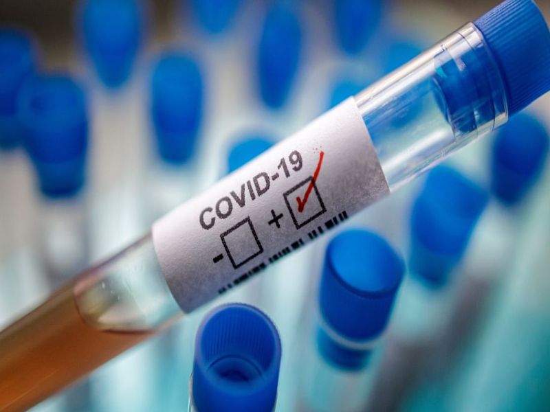 CoronaVirus News: Covid test report stalled in Ambernath, Badlapur; Time to send samples to Ulhasnagar lab | CoronaVirus News : अंबरनाथ, बदलापूरमधील कोव्हिड टेस्टचे रिपोर्ट रखडले; उल्हासनगरच्या लॅबमध्ये नमुने पाठवण्याची वेळ 