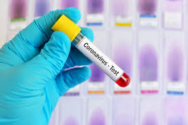 CoronaVirus News: If more than ten Corona patients are found on two floors, the building will be sealed | CoronaVirus News : दोन मजल्यांवर दहापेक्षा अधिक कोरोना रुग्ण सापडल्यास इमारत सील