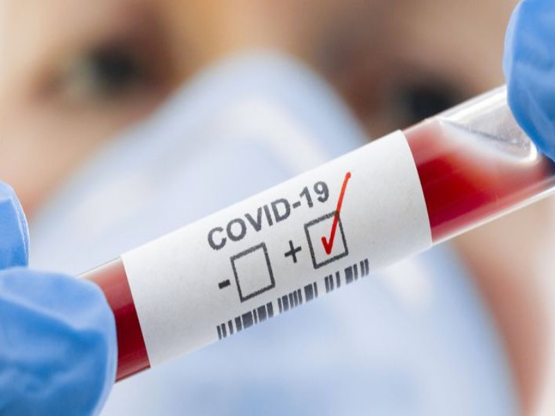 coronavirus: As the number of tests increases, so does the incidence of infections, 19 per cent in the state and 7.09 per cent in the country | coronavirus: चाचण्यांची संख्या वाढल्याने बाधितांचे प्रमाणही वाढतेच, राज्यात १९, तर देशात प्रमाण ७.०९ टक्के