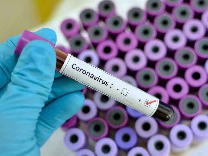 Coronavirus: shocking; The staff in the superintendent's office in Ghati Hospital is positive | Coronavirus : धक्कादायक; अधिष्ठातांच्या कार्यालयातील कर्मचारी पॉझिटिव्ह
