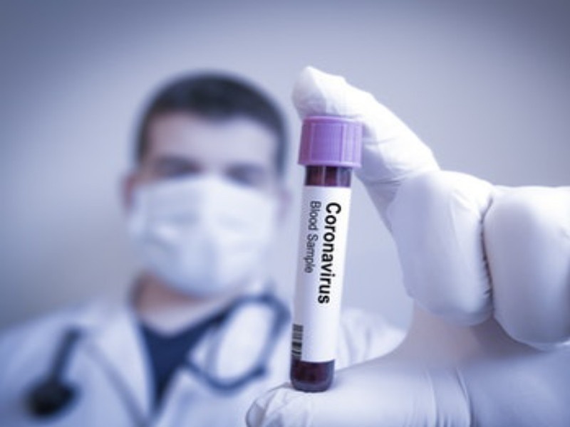 Coronavirus : Everything About Corona Virus Pattern Check ... | Coronavirus : कोरोना विषाणू नमुना तपासणीबाबत सर्वकाही...