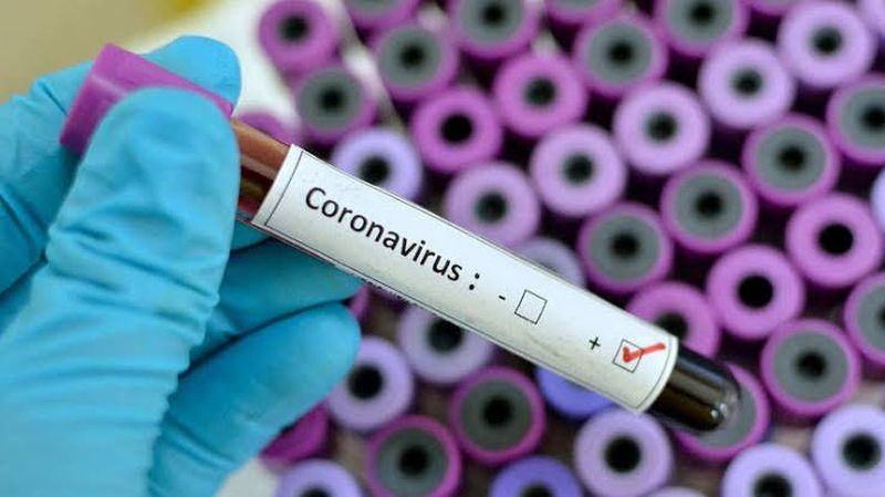 corona virus : Corona's positive patient in Aurangabad; Professor Woman's Corona Report 'Positive' | corona virus : औरंगाबादेत कोरोनाचा शिरकाव; प्राध्यापक महिलेचा कोरोना अहवाल ‘पॉझिटिव्ह’