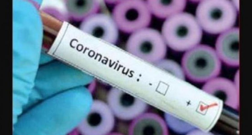 In Nagpur, 24 patients including nurses tested positive, 583 patients | CoronaVirus in Nagpur : नागपुरात परिचारिकेसह २४ रुग्ण पॉझिटिव्ह, रुग्णसंख्या ५८३