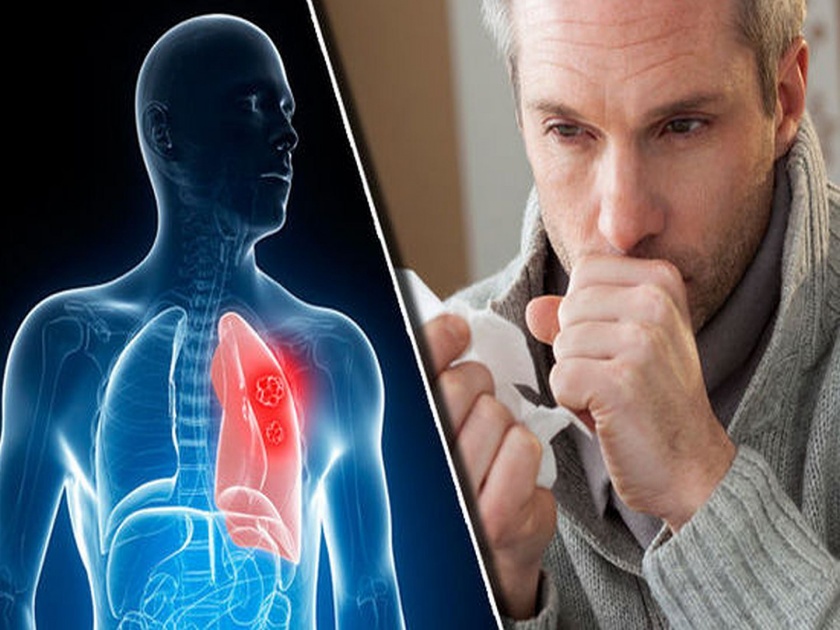 What are the causes and symptoms of accumulation of phlegm in the chest? Learn from experts only symptoms and remedies ... | काय आहेत छातीत कफ जमा होण्याची कारणं? तज्ज्ञांकडूनच जाणून घ्या लक्षणे अन् उपाय...