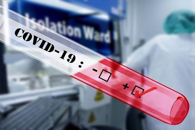 Covid test on HIV viral load device | एचआयव्ही व्हायरल लोड यंत्रावर कोविड तपासणी