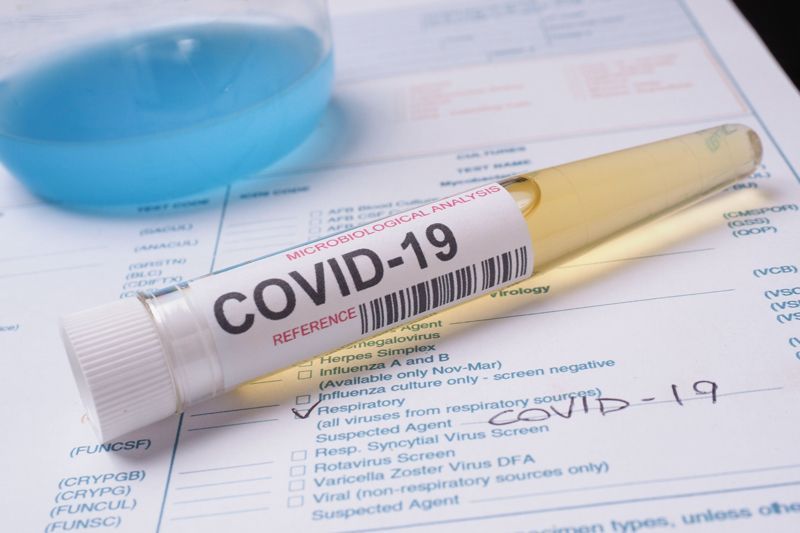 coronavirus: covid-19 is a biological war! World Health Organization Infectious Diseases Specialist Dr. Allegations by Peter Ben Ambarek | coronavirus: कोविड-१९ हे तर जैविक युद्ध! जागतिक स्वास्थ्य संघटनेचे सांसर्गिक रोग विशेषज्ञ डॉ. पीटर बेन एम्बारेक यांचा आरोप
