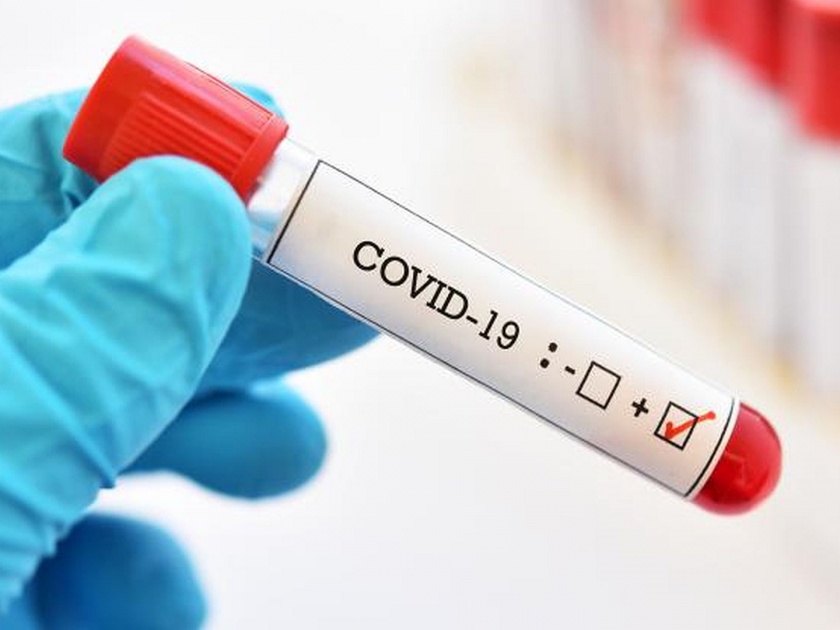 us fda approves first rapid corona virus test with 45 minutes detection vrd | coronavirus : फक्त 45 मिनिटांत होणार कोरोनाग्रस्ताची ओळख; 'या' देशाला मिळालं यश
