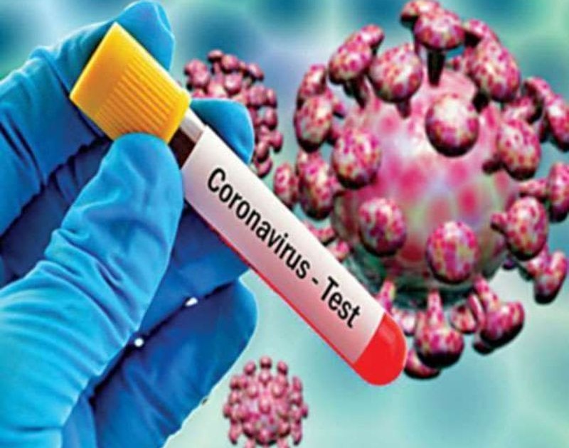 CoronVirus: Another victim of coronavirus; 9 positive, death toll 24 | CoronVirus : कोरोनाचा आणखी एक बळी; ९ पॉझिटिव्ह, मृतकांचा आकडा २४