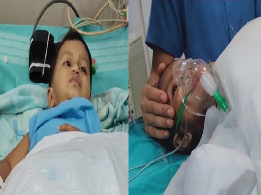 Challenging surgery on a four month old girl at CPR Hospital in Radhanagari taluka | 'त्या' दोन निरागस मुलींना भेटले साक्षात देव, ..अन् मिळाले जीवदान