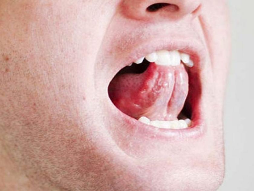 The wife broke the tip of her husband's tongue with her teeth | पत्नीने दाताने तोडला पतीच्या जिभेचा लचका