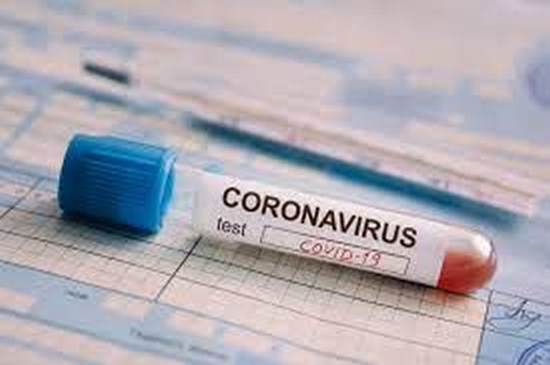 CoronaVirus: Another death; 73 Positive | CoronaVirus : आणखी एकाचा मृत्यू; ७३ पॉझिटिव्ह