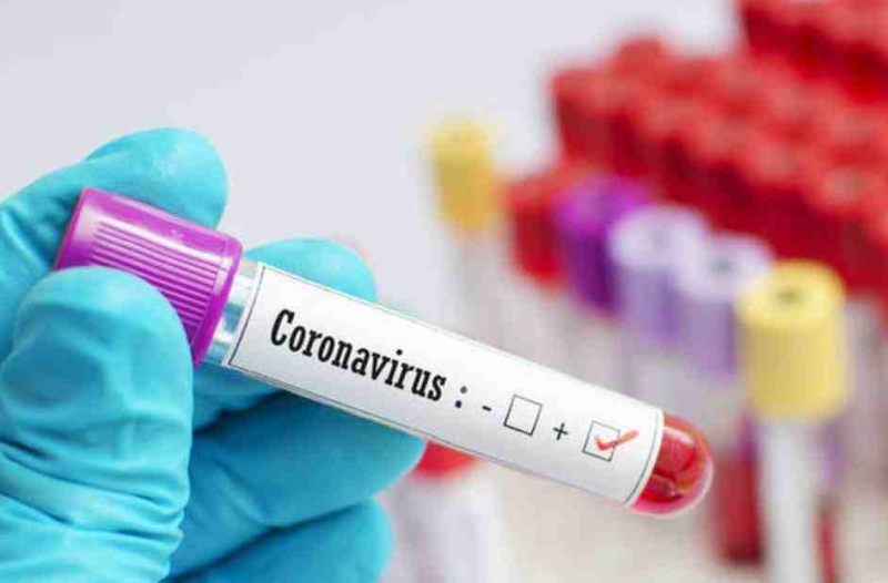 Coronavirus: Another 16 patients tested positive for coronavirus in Yavatmal MMG | Coronavirus: यवतमाळमध्ये आणखी १६ रुग्ण पॉझिटिव्ह, कोरोनाग्रस्तांची संख्या ४१