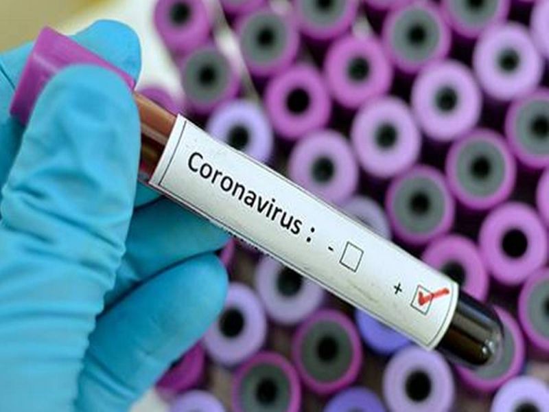 Coronavirus Homeownership Corona test; Online facilities from the government | Coronavirus घरबसल्या करा कोरोनाची चाचणी; सरकारकडून ऑनलाइन सुविधा