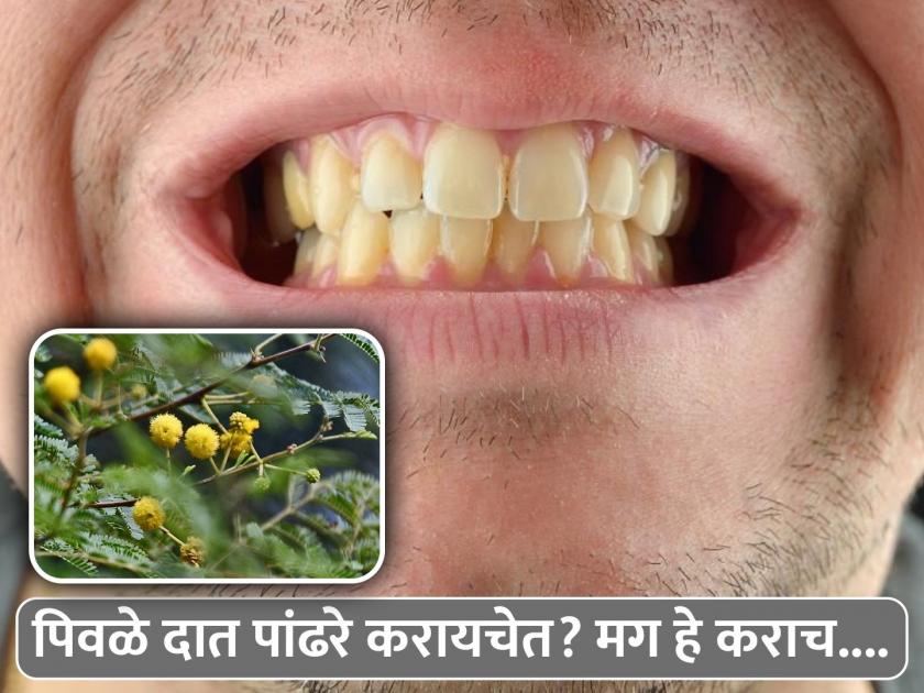Ayurvedic home remedies to make yellow teeth white | पिवळे दात पांढरे करण्याचे बेस्ट आयुर्वेदिक उपाय, 'या' झाडांची पाने ठरतील फायदेशीर!