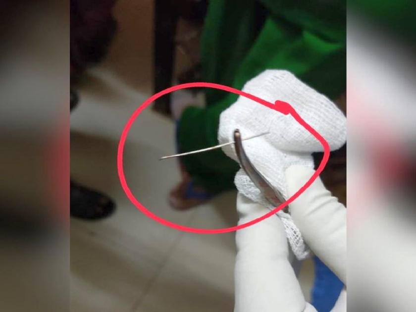 During the injection, the needle came out of the syringe and entered directly into the patient's body | बापरे ! इंजेक्शन देताना सुई रुग्णाच्या शरीरात घुसली