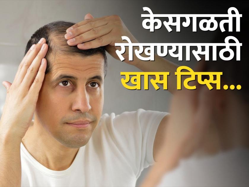 Hair Care Tips : Home remedies for male pattern hair loss | उन्हाळ्यात वाढते केसगळतीची समस्या, जाणून घ्या काय कराल उपाय!