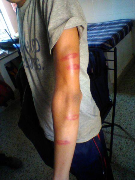 In the school ninth class student brutally beaten | शाळेत नववीच्या विद्यार्थ्यास अमानुष मारहाण