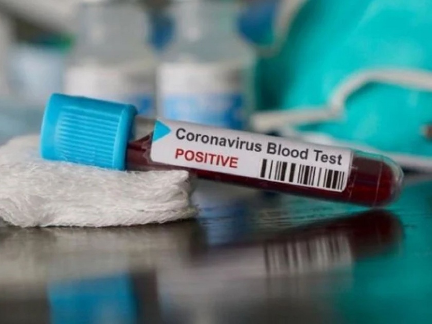 CoronaVirus first corona positive patient found in Osmanabad hrb | CoronaVirus पत्नीसह पानिपतला जाऊन आला; उस्मानाबादमध्ये पहिला कोरोनाग्रस्त सापडला