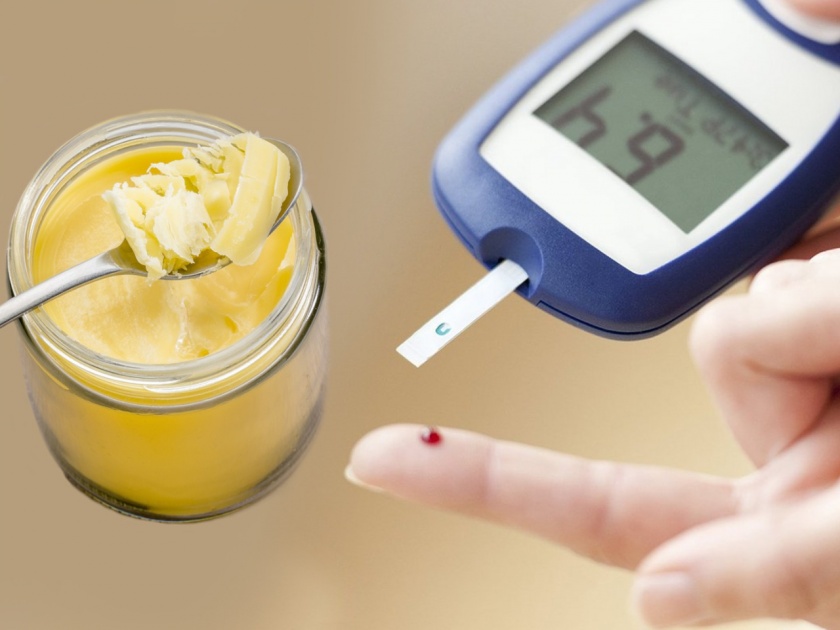 Should diabetic patients eat desi ghee or not | डायबिटीसच्या रूग्णांनी आहारात तूपाचा समावेश करावा की, नाही?