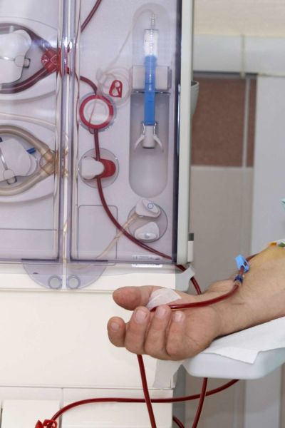 Dialysis Patients should take care: Appeal to the Nephrology Society | डायलिसिसच्या रुग्णांनो काळजी घ्या : नेफ्रोलॉजी सोसायटीचे आवाहन