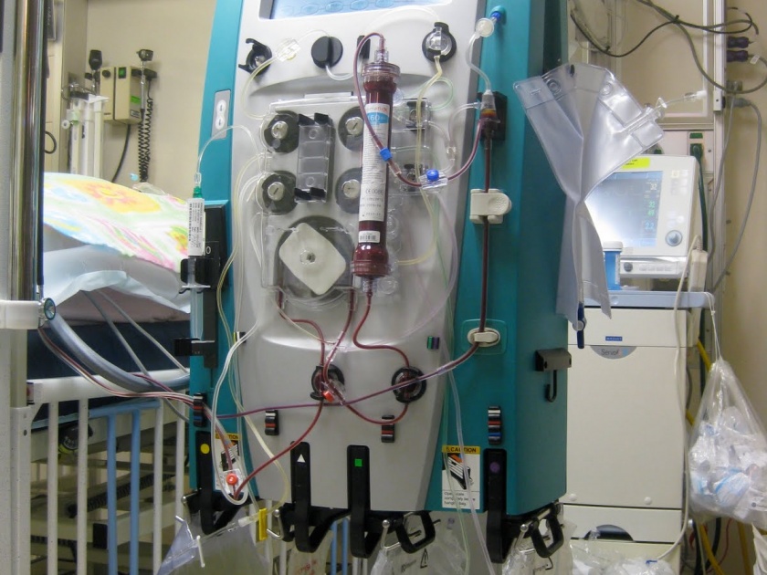 Dialysis patient deprived from treatment in Nagpur | उपचारापासून नागपुरातील डायलिसिसचे रुग्ण वंचित
