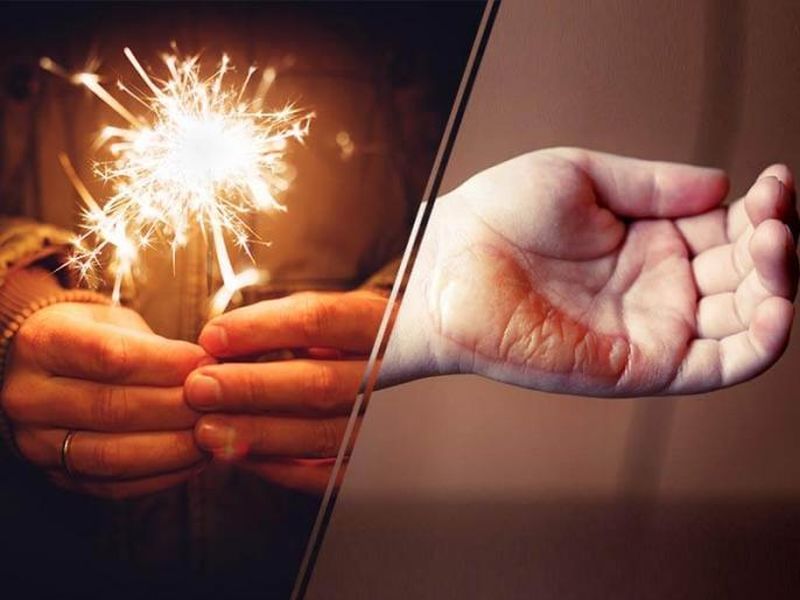 Diwali Safety Tips : 7 home remedies use to get relief form firecracker burns | Diwali 2018 : फटाक्याने त्वचा जळली तर काय कराल आणि काय नाही?
