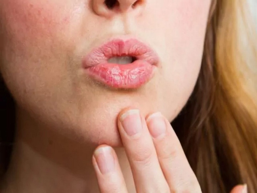 Tips to cure cracked lips in Winter | हिवाळ्यात मुलायम आणि गुलाबी ओठांसाठी वापरा 'या' सोप्या टिप्स, ओठांचा ड्रायनेस करा झटपट दूर....