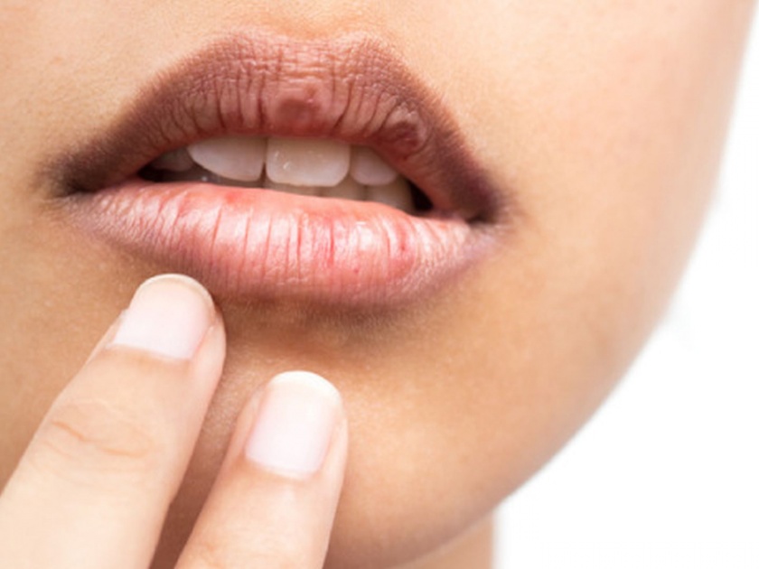 Homemade tips and tricks for soft and healthy lips | ओठांच्या ड्रायनेसमुळे मेकअपचा होतोय का सत्यानाश? या घरगुती टिप्स येतील कामात!