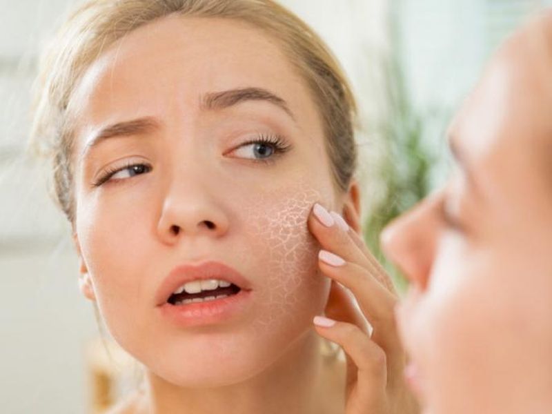 Winter skin care tips for dry skin | Winter Skin Care: ड्राय स्किन असणाऱ्यांसाठी काही खास टिप्स; चेहरा तजेलदार दिसण्यास होईल मदत!
