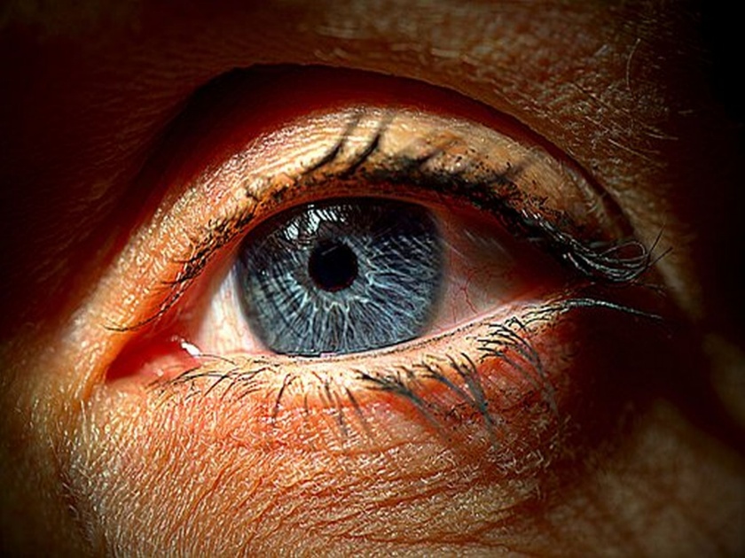 American scientist made adhesive gel to repair eye injury without surgery | सर्जरीची भीती विसरा... जेलच्या मदतीने डोळ्यांच्या जखमेवर होणार उपचार!
