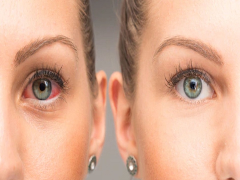 Diseases conditions eyes are telling you health do not ignore | डोळे सांगतात तुमच्या आरोग्याची स्थिती; चुकूनही करू नका दुर्लक्ष