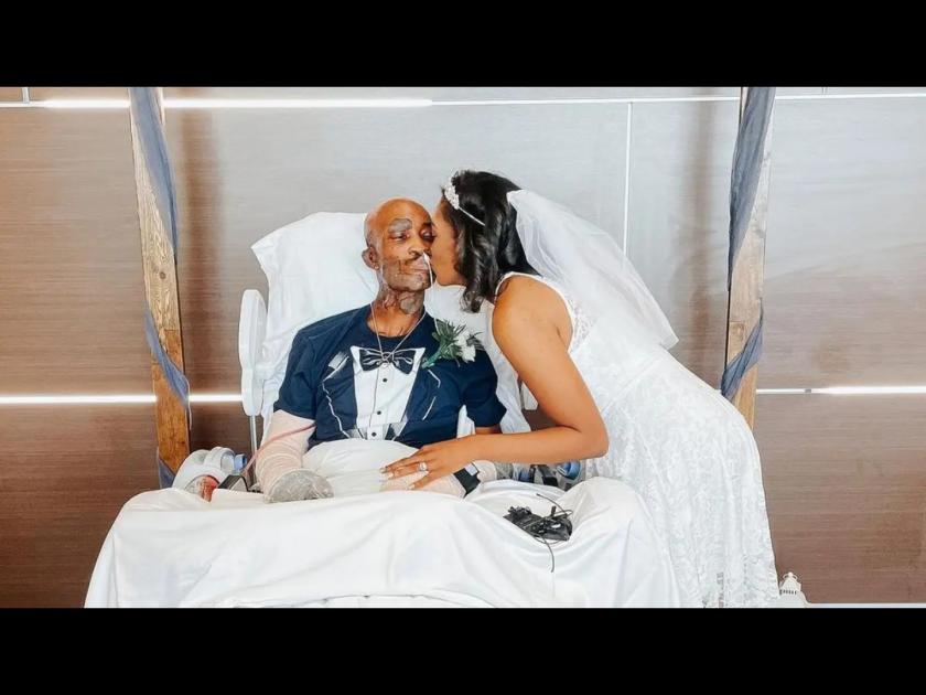 Couple gets married in hospital after groom sustained 32% burn injuries just before their wedding | लग्नाआधी जळालं होतं नवरदेवाचं शरीर, नवरीने हॉस्पिटलमध्ये येऊन बांधली लग्नाची गाठ