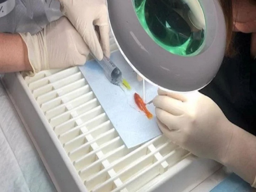 Tiny fish weighing one gram is in good health after becoming smallest surgical patient | एक ग्रॅम माशाच्या पोटात झाला होता ट्यूमर, मालकाने ऑपरेशनसाठी ९ हजार रूपये खर्च करून वाचवला जीव...