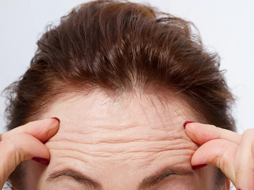 Want to get rid of forehead wrinkles? Use these home remedies | कपाळावरील सुरकुत्या नेहमीसाठी होतील गायब, करा हे घरगुती पाच उपाय!