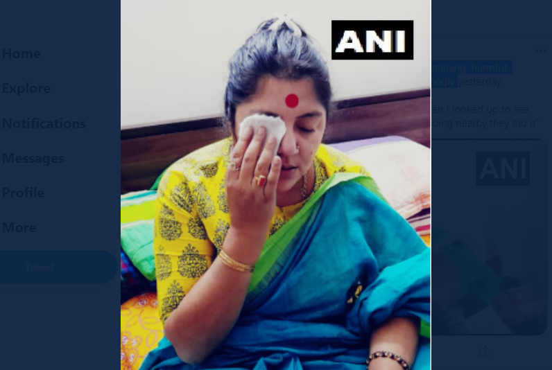 BJP's Locket Chatterjee alleges that colours containing 'harmful chemicals' was thrown on her face | भाजपाच्या महिला उमेदवारावर फेकला विषारी रंग; प्रकृती चिंताजनक, TMC वर केला गंभीर आरोप