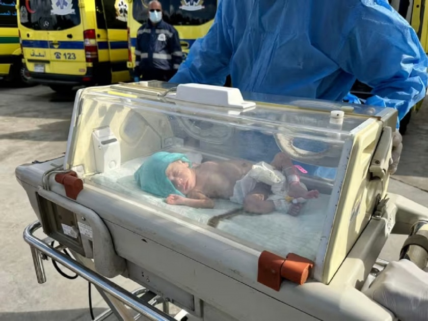 Israel-Hamas-war-gaza-doctors-save-baby-from-womb-of-mother-killed-in-israeli-air-strikes | इस्रायल-हमास युद्धातील अनोखी घटना; हल्ल्यात आईचा मृत्यू, पोटात चिमुकली जिवंत...