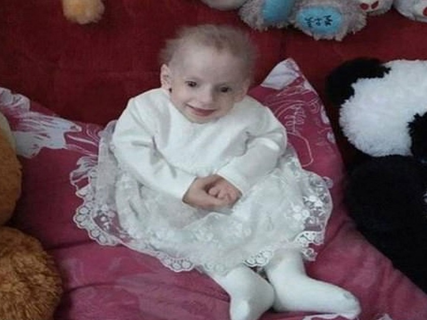 Girl aged 8 dies of old age in ukraine after genetic disease | धक्कादायक! ८ वर्षातच जगली ८० वर्षाचं आयुष्य, बालपणीच वृद्ध होऊन मुलीचा मृत्यू!