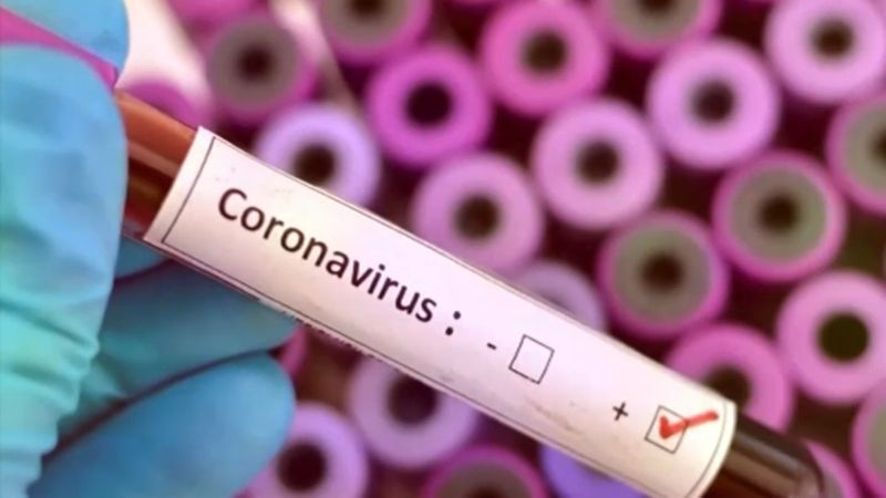 Corona Virus in Nagpur: 982 new positive, 38 patients die in Nagpur | CoronaVirus in Nagpur : नागपुरात ९८२ नवीन पॉझिटिव्ह, ३८ रुग्णांचा मृत्यू