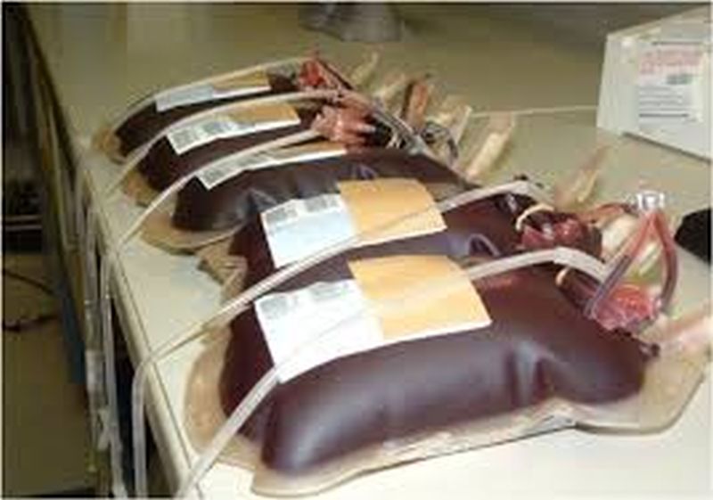 Blood component stored in government blood bank stopped | शासकीय रक्तपेढीत ‘ब्लड कंपोनंट’ची साठवणूक ठप्प!
