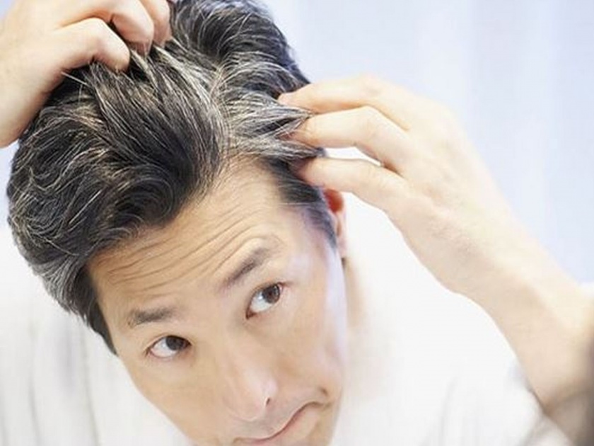 Gray hair problem in young age? Know how to take care of it | कमी वयातच पांढरे झालेले केस पुन्हा करा काळे, कसे ते जाणून घ्या!