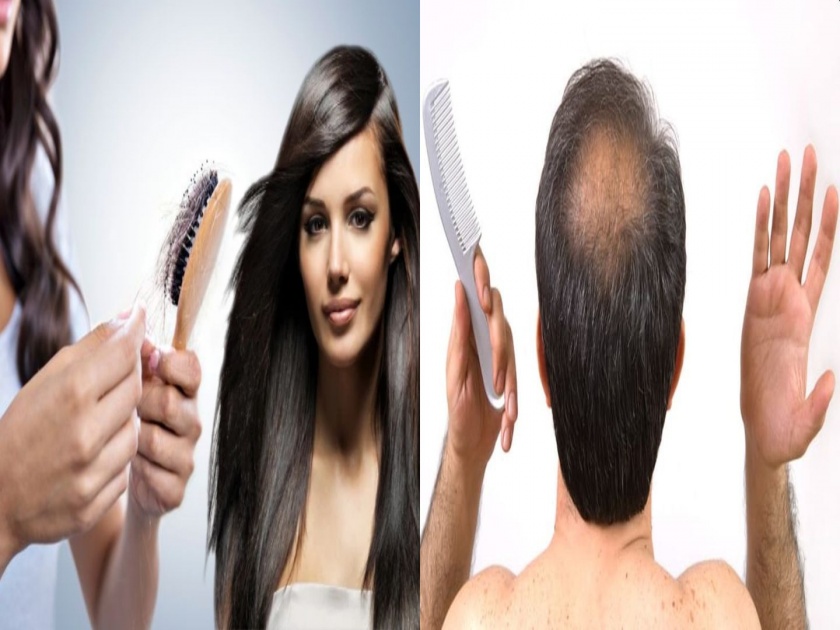 Home remedies for hair loss problems in lockdown myb | लॉकडाऊनमध्ये दाट केस मिळवा; केस गळणं थांबवण्यासाठी घरच्याघरी वापरा 'हे' खास फंडे