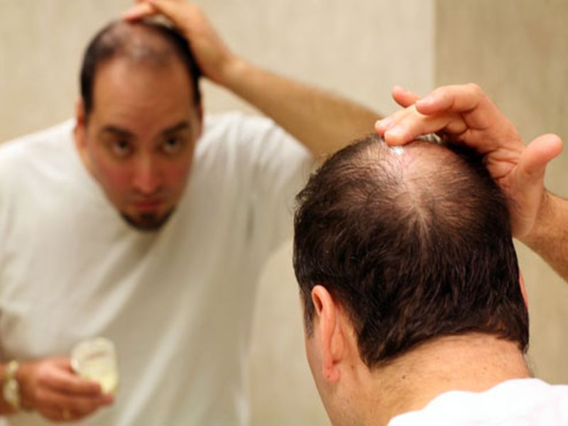 Easy tips for daily hair care to stop Hairfall | केसगळती थांबवण्यासाठी पुरुषांनी 'या' गोष्टींची घ्यावी काळजी!
